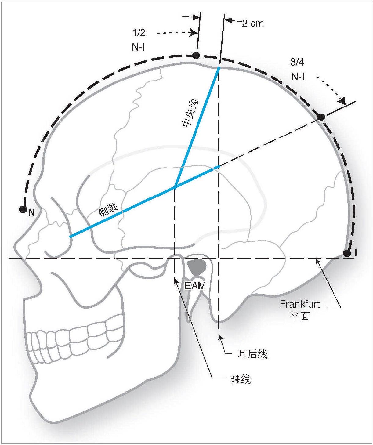 1.3 顱骨表面解剖